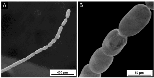 Detailed image of the largest bacteria in the world